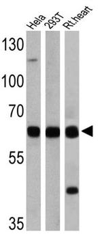 FOXO1 Antibody in Western Blot (WB)