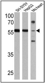 RARB Antibody in Western Blot (WB)