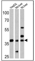 FOXA3 Antibody in Western Blot (WB)