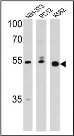 PPAR delta Antibody in Western Blot (WB)