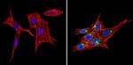 SNX1 Antibody in Immunocytochemistry (ICC/IF)