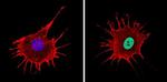 NCoR2 Antibody in Immunocytochemistry (ICC/IF)