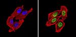 NCoR2 Antibody in Immunocytochemistry (ICC/IF)