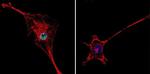 HDAC2 Antibody in Immunocytochemistry (ICC/IF)