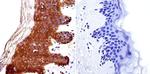 HDAC4 Antibody in Immunohistochemistry (Paraffin) (IHC (P))