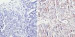 SIN3A Antibody in Immunohistochemistry (Paraffin) (IHC (P))