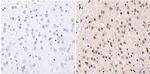 DNMT3B Antibody in Immunohistochemistry (Paraffin) (IHC (P))