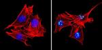 MECP2 Antibody in Immunocytochemistry (ICC/IF)