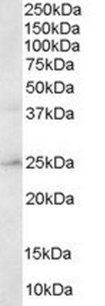 ERAB Antibody in Western Blot (WB)