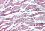 AKT3 Antibody in Immunohistochemistry (Paraffin) (IHC (P))