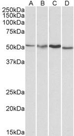 AKT3 Antibody in Western Blot (WB)