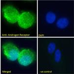 Androgen Receptor Antibody in Immunocytochemistry (ICC/IF)