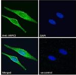 ARPC2 Antibody in Immunocytochemistry (ICC/IF)