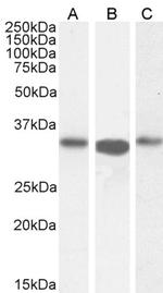 ARPC2 Antibody in Western Blot (WB)