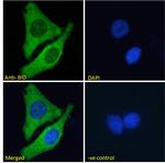 BID Antibody in Immunocytochemistry (ICC/IF)