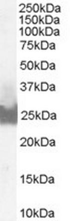 BID Antibody in Western Blot (WB)