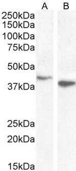 Bif1 Antibody in Western Blot (WB)