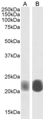 Caveolin 1 Antibody in Western Blot (WB)