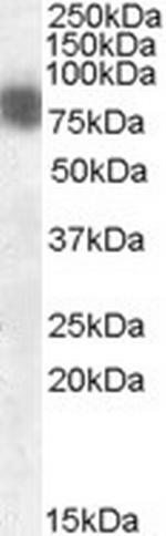 Cortactin Antibody in Western Blot (WB)