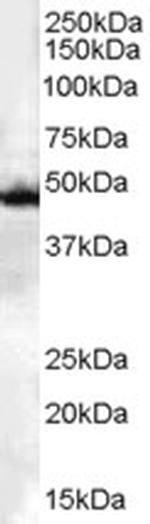 CSK Antibody in Western Blot (WB)