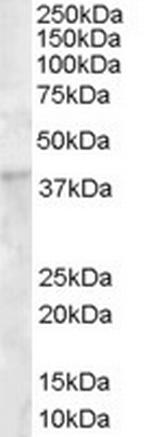 DKK1 Antibody in Western Blot (WB)