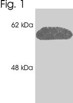 Calreticulin Antibody in Western Blot (WB)