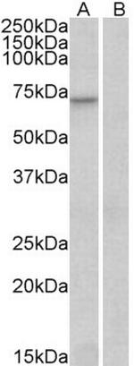 FOXO3A Antibody in Western Blot (WB)