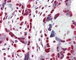 HP1 gamma Antibody in Immunohistochemistry (Paraffin) (IHC (P))