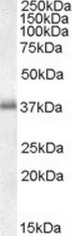 LAT Antibody in Western Blot (WB)