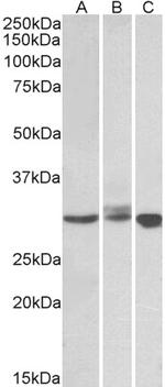 Livin Antibody in Western Blot (WB)