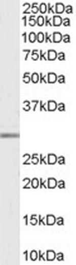 MMP7 Antibody in Western Blot (WB)