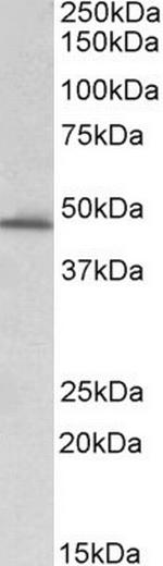 PAI1 Antibody in Western Blot (WB)