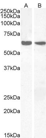 PPP2R1A Antibody in Western Blot (WB)