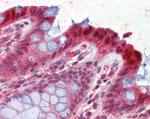 15-PGDH Antibody in Immunohistochemistry (Paraffin) (IHC (P))