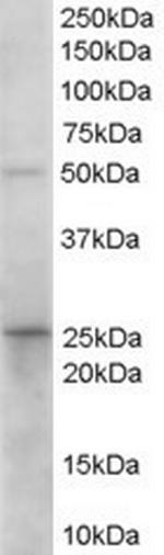 15-PGDH Antibody in Western Blot (WB)