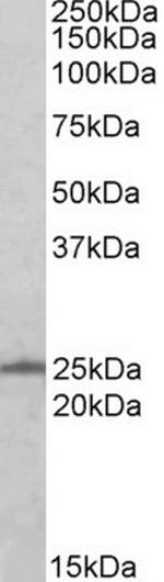 RAN Antibody in Western Blot (WB)