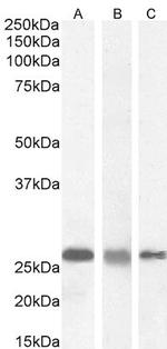 RANBP1 Antibody in Western Blot (WB)