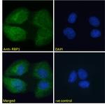 RBP1 Antibody in Immunocytochemistry (ICC/IF)