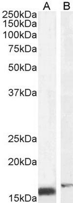 RBP1 Antibody in Western Blot (WB)