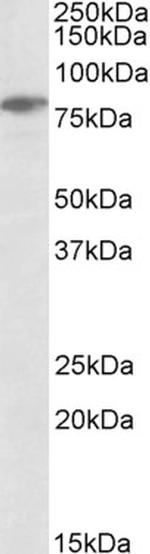 SLP76 Antibody in Western Blot (WB)