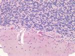 Survivin Antibody in Immunohistochemistry (Paraffin) (IHC (P))