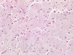 Survivin Antibody in Immunohistochemistry (Paraffin) (IHC (P))