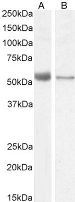 VDR Antibody in Western Blot (WB)