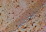 TRPM7 Antibody in Immunohistochemistry (Paraffin) (IHC (P))