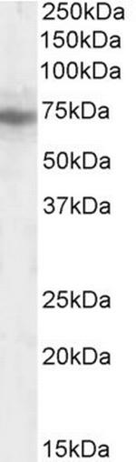 CMG1 Antibody in Western Blot (WB)