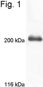 MYO7A Antibody in Western Blot (WB)