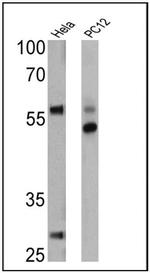 TRAIL-R2 (DR5) Antibody in Western Blot (WB)