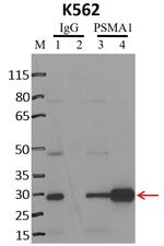 PSMA1 Antibody in RNA Immunoprecipitation (RIP)