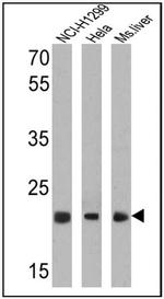 PSMB5 Antibody in Western Blot (WB)