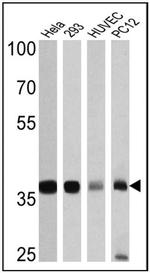 GAPDH Antibody in Western Blot (WB)